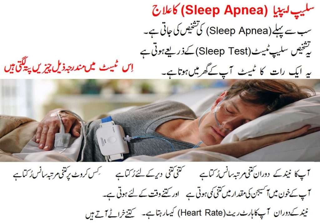 Treatment of Sleep Apnea